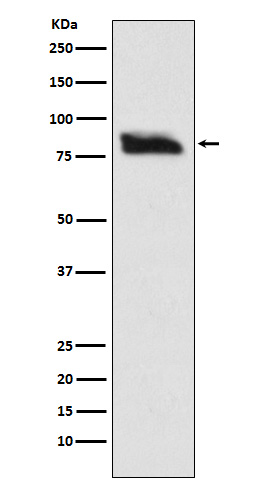 Western blot analysis of SMURF 2 expression in SH-SY-5Y cell lysate