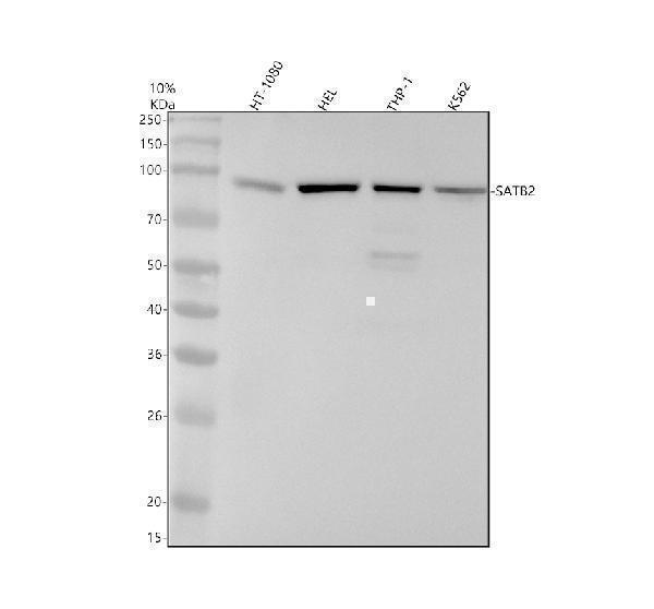 Western blot analysis of SATB2 using anti-SATB2 antibody (M02588-2)