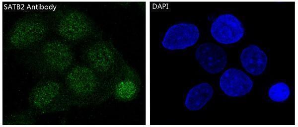 m02588 satb2 primary antibodies if testing 3