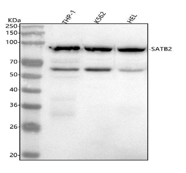 m02588 satb2 primary antibodies wb testing 1