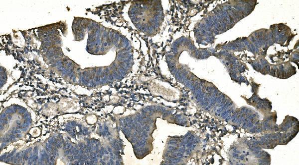  IHC analysis of CD13/ANPEP using anti-CD13/ANPEP antibody (M02591-4)