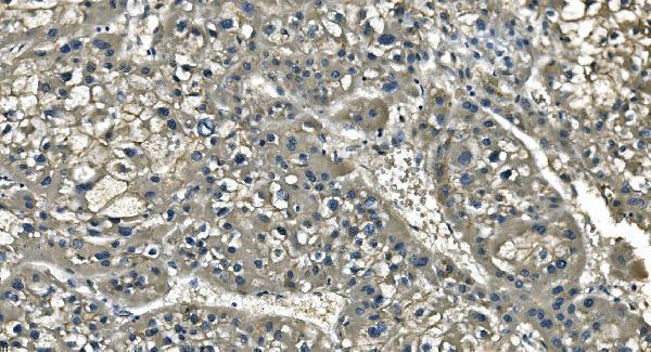 m02591 4 anpep primary antibodies ihc testing 4