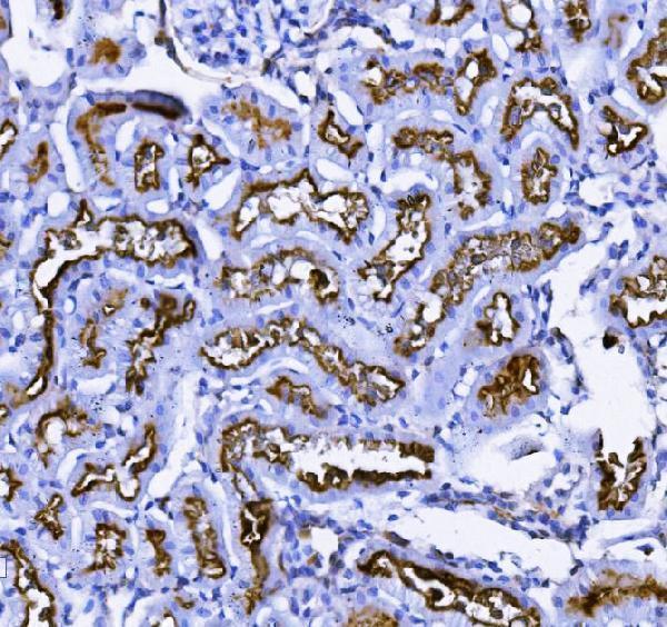 m02591 4 anpep primary antibodies ihc testing 6