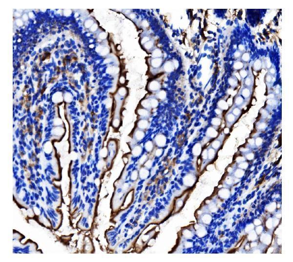m02591 5 anpep primary antibodies ihc testing 5