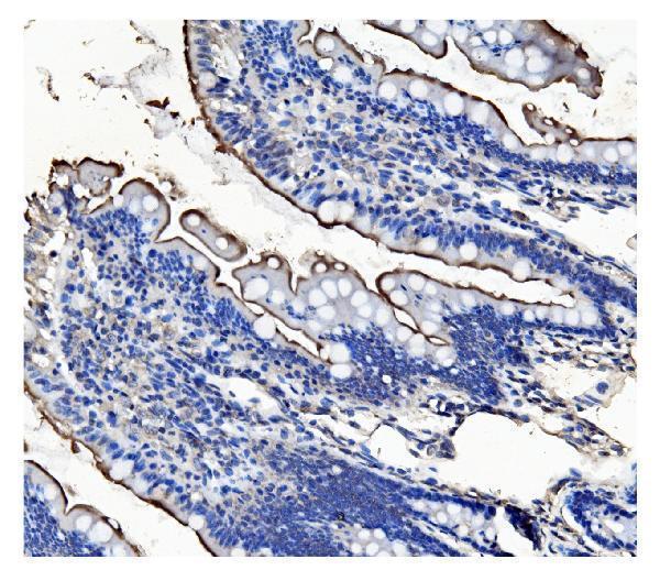  IHC analysis of CD13/ANPEP using anti-CD13/ANPEP antibody (M02591-6)