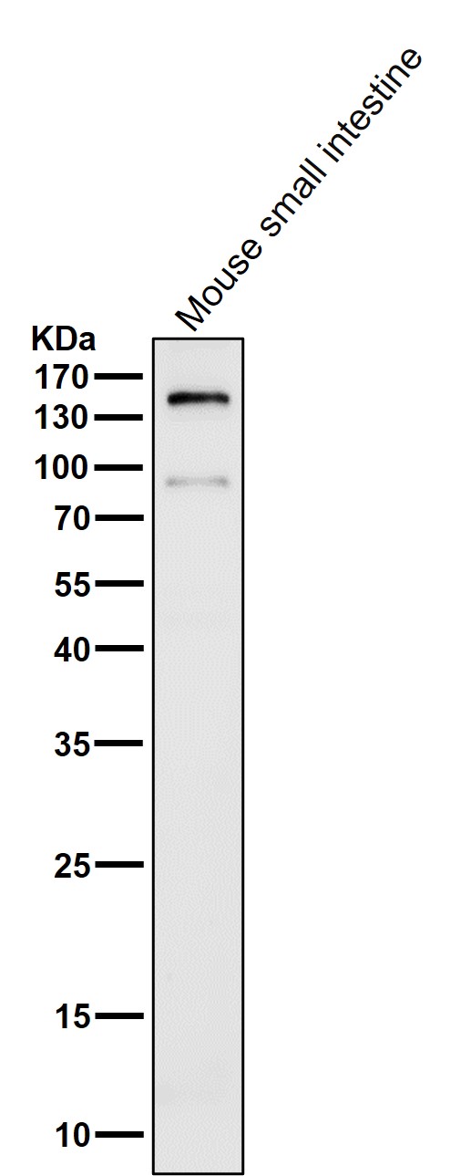 All lanes use the Antibody at 1:2K dilution for 1 hour at room temperature