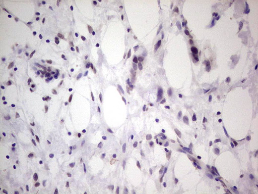 m02592 anti tcf12 mouse monoclonal antibody clone id oti4d6 ihc testing 4