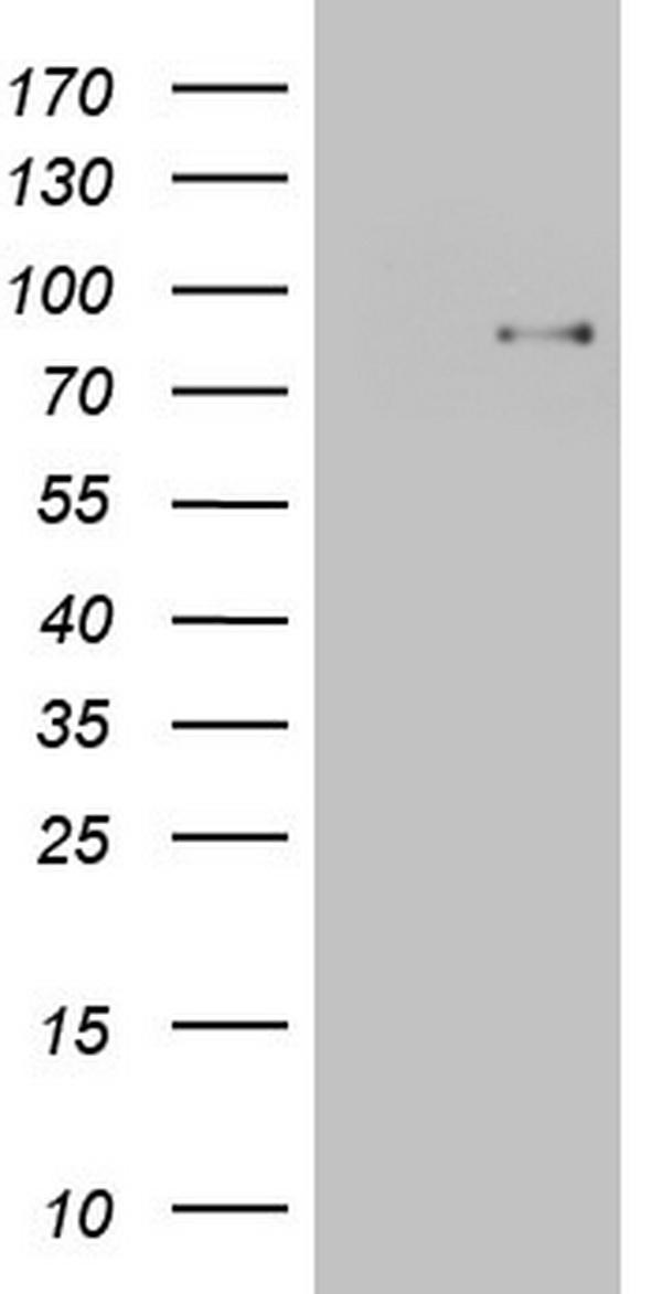 HEK293T cells were transfected with the pCMV6-ENTRY control (Left lane) or pCMV6-ENTRY TCF12 (Right lane) cDNA for 48 hrs and lysed