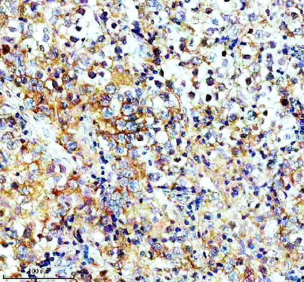 IHC analysis of USP9X using anti-USP9X antibody (M02594-1)
