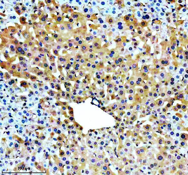 IHC analysis of USP9X using anti-USP9X antibody (M02594-1)