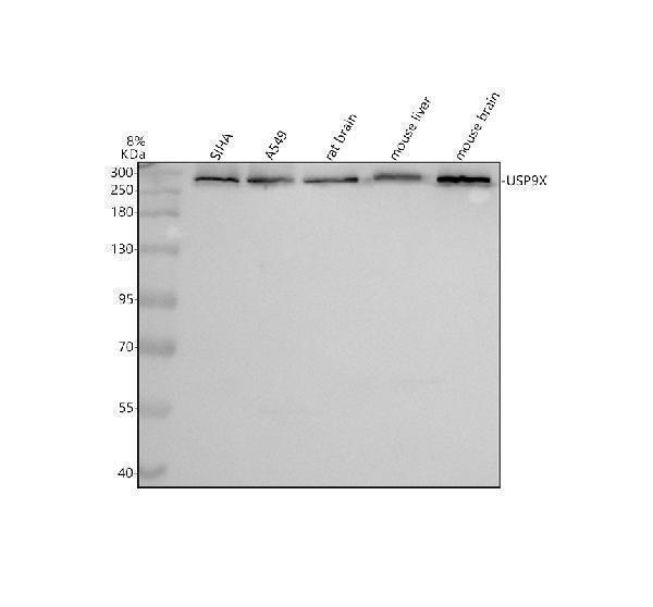 Western blot analysis of USP9X using anti-USP9X antibody (M02594-1)