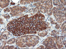 m02594 anti usp9x mouse monoclonal antibody clone id oti2g7 ihc testing 5