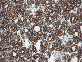 m02594 anti usp9x mouse monoclonal antibody clone id oti2g7 ihc testing 6
