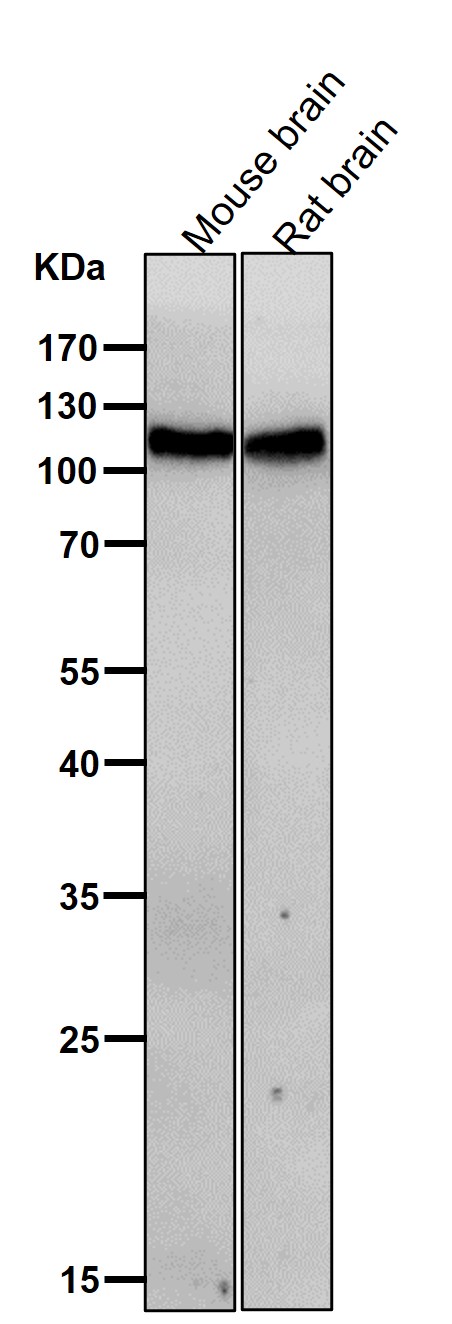 All lanes use the Antibody at 1:1K dilution for 1 hour at room temperature