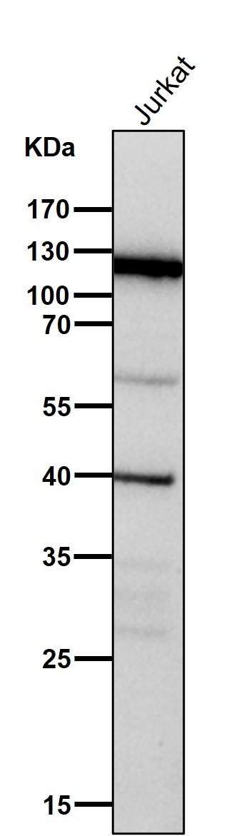 All lanes use the Antibody at 1:1K dilution for 1 hour at room temperature