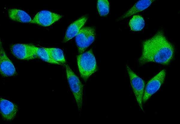 m02602 1 snd1 primary antibodies if testing 8