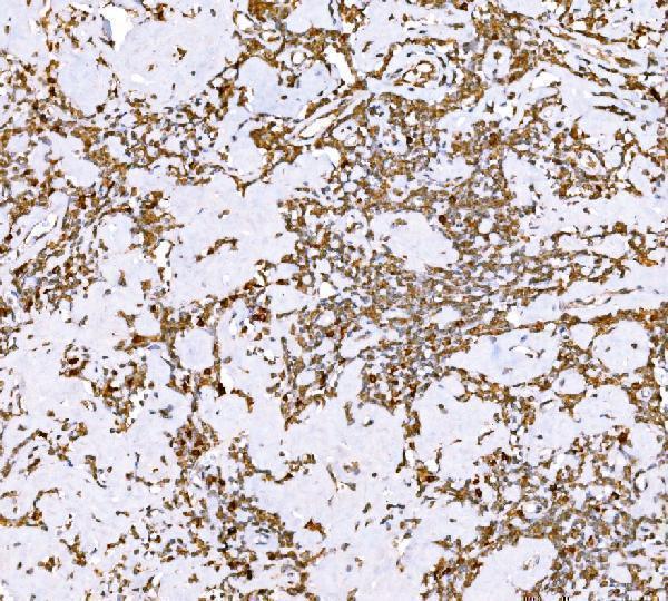  IHC analysis of SND1 using anti-SND1 antibody (M02602-1)