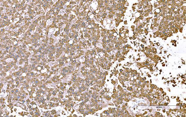  IHC analysis of SND1 using anti-SND1 antibody (M02602-1)
