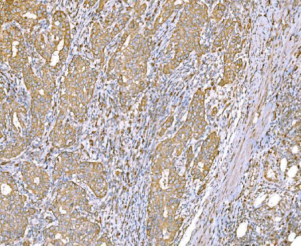 m02602 1 snd1 primary antibodies ihc testing 4