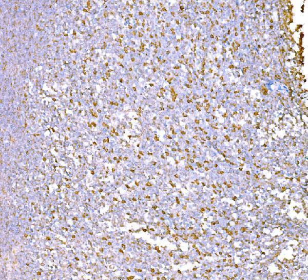 m02602 1 snd1 primary antibodies ihc testing 5