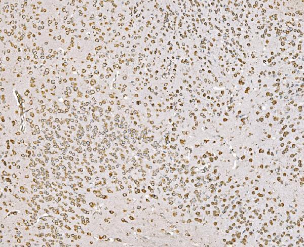 m02602 1 snd1 primary antibodies ihc testing 6