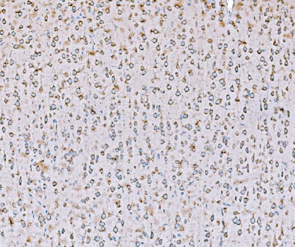 m02602 1 snd1 primary antibodies ihc testing 7