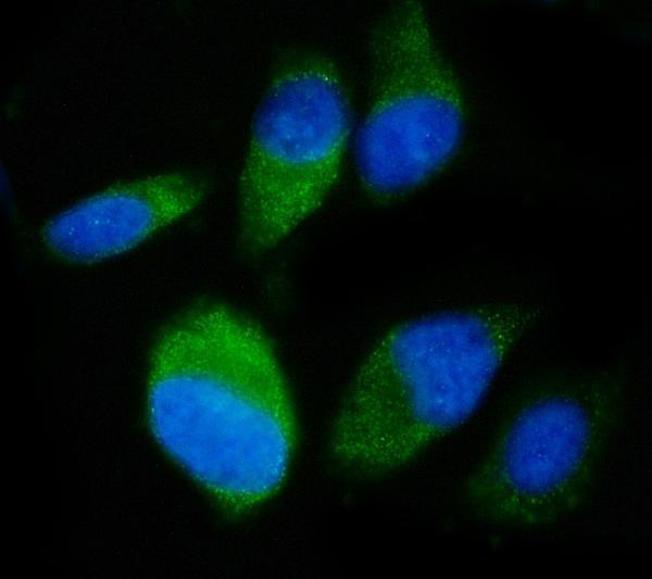 m02602 2 snd1 primary antibodies if testing 9