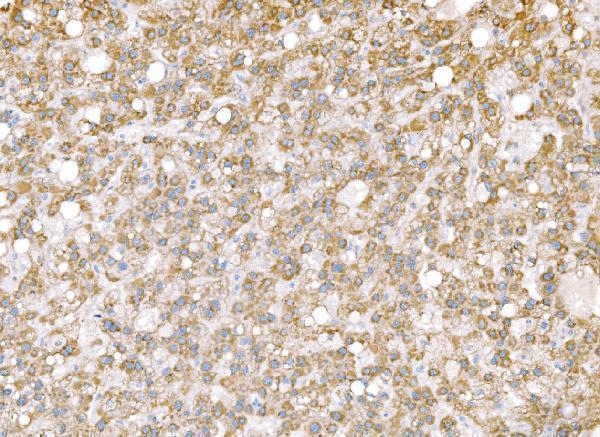  IHC analysis of SND1 using anti-SND1 antibody (M02602-2)