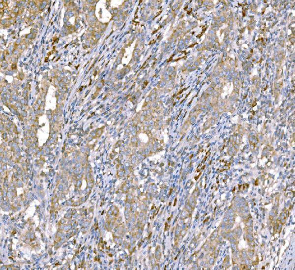  IHC analysis of SND1 using anti-SND1 antibody (M02602-2)