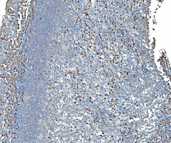m02602 2 snd1 primary antibodies ihc testing 4