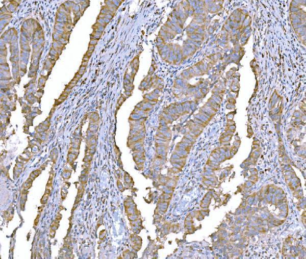 m02602 2 snd1 primary antibodies ihc testing 5