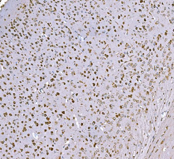 m02602 2 snd1 primary antibodies ihc testing 6