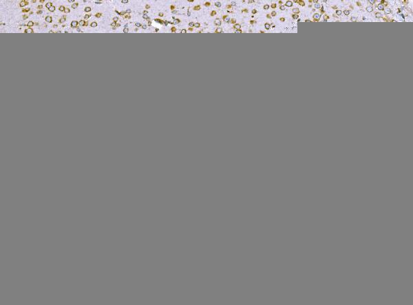 m02602 2 snd1 primary antibodies ihc testing 7