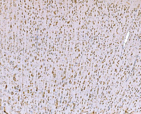 m02602 2 snd1 primary antibodies ihc testing 8