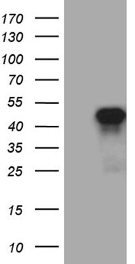 HEK293T cells were transfected with the pCMV6-ENTRY control (Left lane) or pCMV6-ENTRY SIX3 (Right lane) cDNA for 48 hrs and lysed