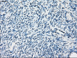 Immunohistochemical staining of paraffin-embedded Ovary tissue within the normal limits using anti-PDE10A mouse monoclonal antibody