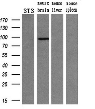 Western blot analysis of extracts (10ug) from a mouse cell line and 3 different mouse tissues by using anti-PDE10A monoclonal antibody (1:200)