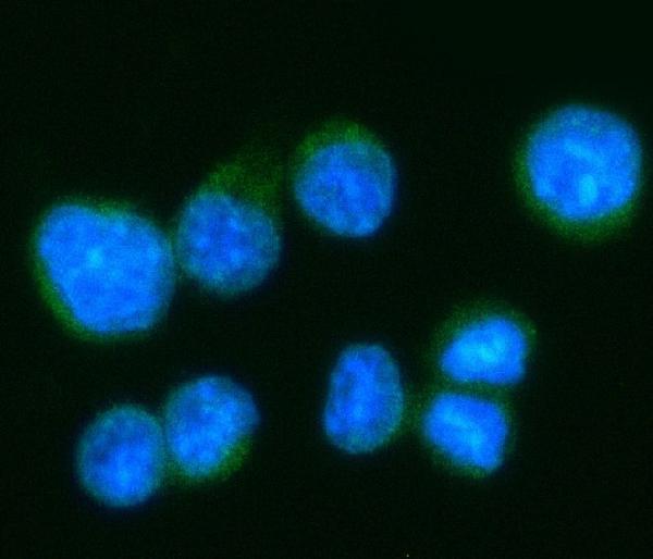 m02611 camk2d primary antibodies icc testing 1