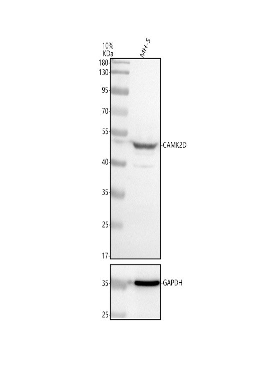 m02611 camk2d primary antibodies wb testing 2