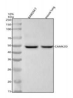 m02611 camk2d primary antibodies wb testing 3