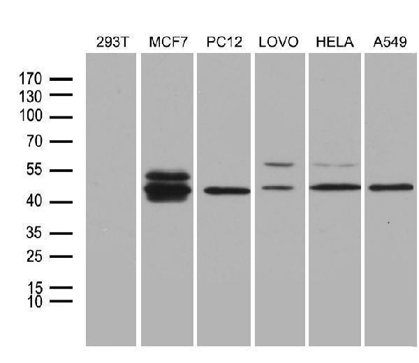 Western blot analysis of extracts (35ug) from 6 different cell lines by using anti-FOSL2 monoclonal antibody (1:500)