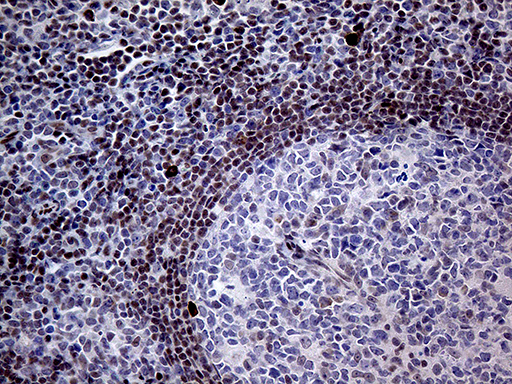 Immunohistochemical staining of paraffin-embedded Human lymph node tissue within the normal limits using anti-FOSL2 mouse monoclonal antibody