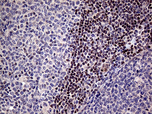 Immunohistochemical staining of paraffin-embedded Human tonsil within the normal limits using anti-FOSL2 mouse monoclonal antibody