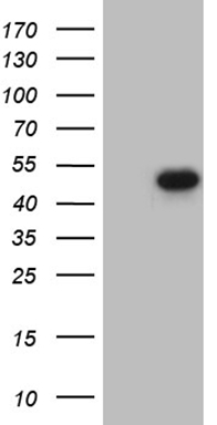HEK293T cells were transfected with the pCMV6-ENTRY control (Left lane) or pCMV6-ENTRY FOSL2 (Right lane) cDNA for 48 hrs and lysed