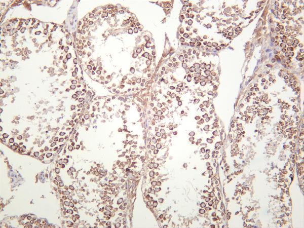 m02621 1 ythdf2 primary antibodies ihc testing 1