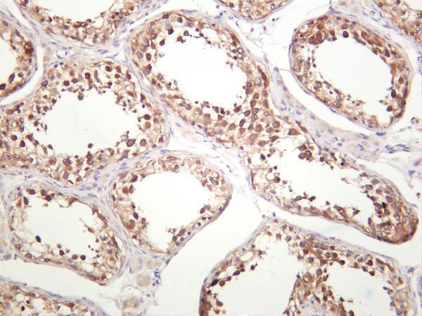 m02621 1 ythdf2 primary antibodies ihc testing 2