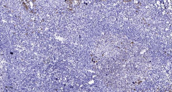 m02632 3 cdh5 primary antibodies ihc testing 1
