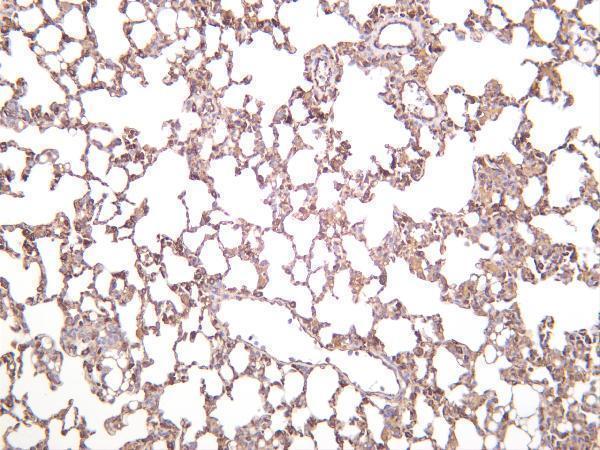 Mouse lung was stained with anti-VE Cadherin rabbit antibody