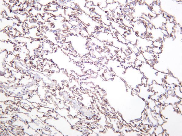 Rat lung was stained with anti-VE Cadherin rabbit antibody