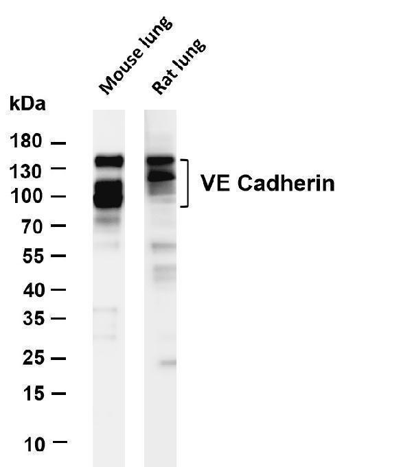 Various whole cell lysates were separated by 4-20% SDS-PAGE, and the membrane was blotted with anti-VE Cadherin antibody